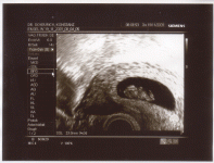 gummibaerle-10-woche_