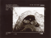 gummibaerle-12-woche_