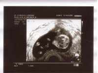 gummibaerle-14-woche_