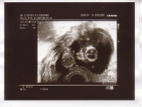 gummibaerle-14-woche_kopf