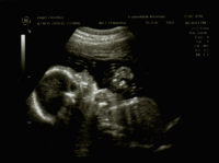 gummibaerle-26-woche_