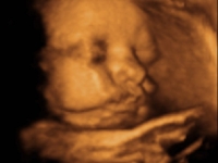 gummibaerle-34-woche_3d